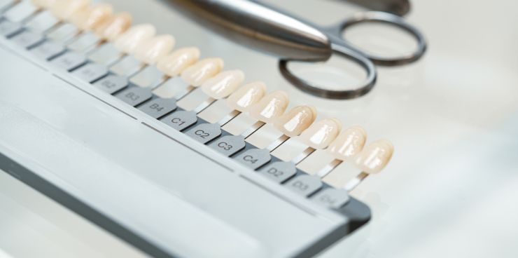Vetrica Clinic Dental Veneers